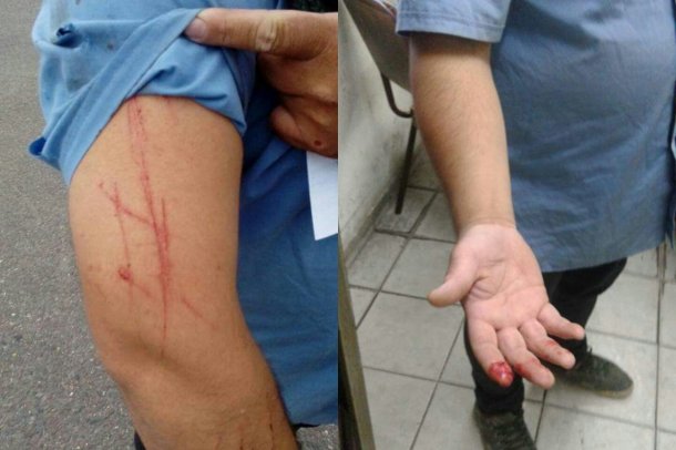 La víctima, identificada como Isaías Gerez, fue herida en un brazo y en una mano.