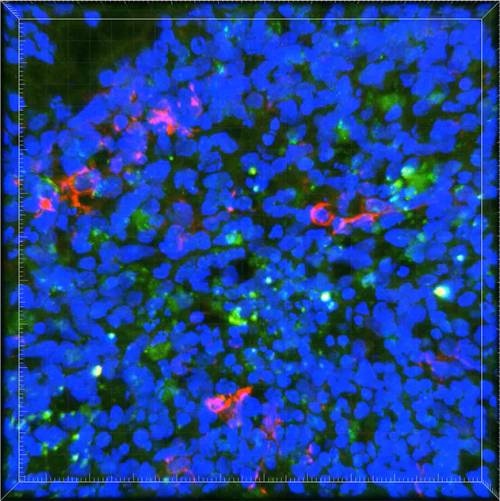 Unos neurocientíficos del MIT han realizado un estudio sobre el gen Apoe4, que incrementa el riesgo de padecer Alzheimer, y sobre la forma más común del gen, el Apoe3. (Imagen: cortesía de los investigadores)