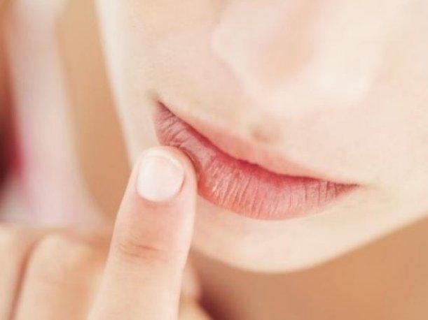 Labios resecos