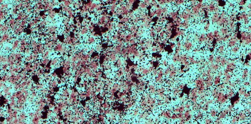 Microfotografía que muestra el daño cerebral que puede ocasionar una intoxicación aguda con alcohol en ratas postnatales. (Foto: UNCiencia)