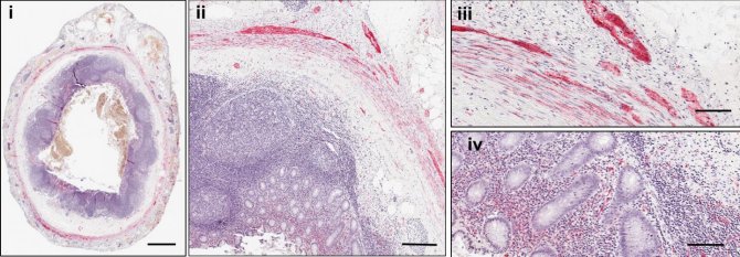 (Foto: B.A. Killinger et al., Science Translational Medicine (2018))