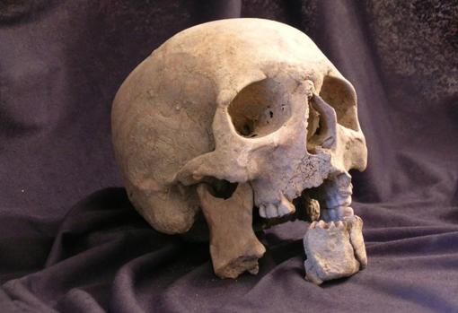 Cráneo del soldado francés cuyo rostro ha sido recreado-Coutinho Nogueira-International Journal of Osteoarchaeology,2018