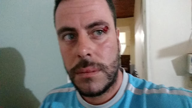 Golpearon a militante social que denunció a la fundación vinculada a Bergman.