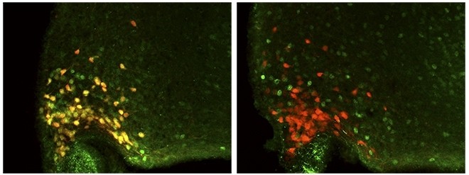 A la derecha, neuronas AgRP de animales nocaut para el receptor de GH; a la izquierda, neuronas de animales de control. (Foto: Nature Communications)