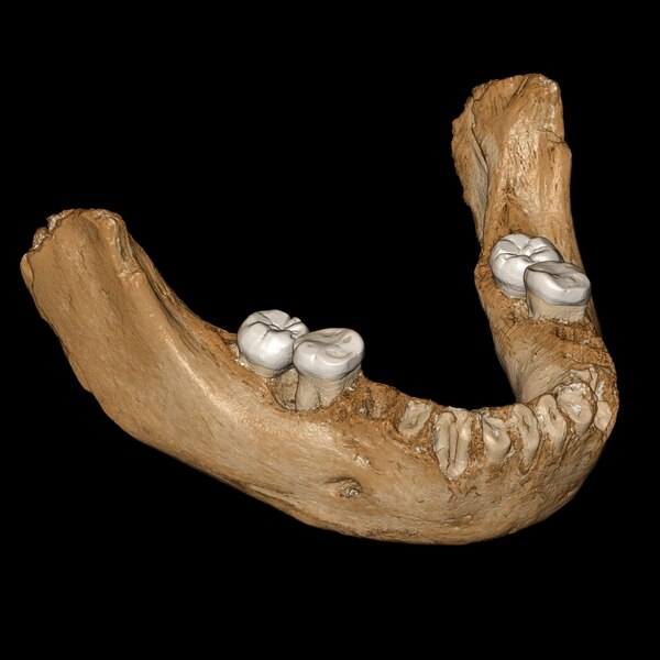 Una mandíbula robusta con grandes dientes permitirá a los paleantropólogos conocer más de esta especie.