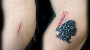 Tatuaje sobre cicatriz.