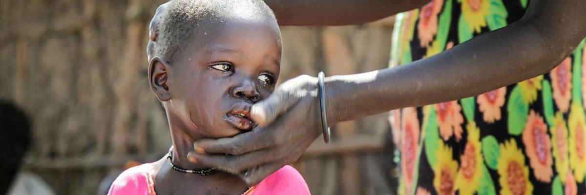 Muchos niños refugiados, como Nyaniela, que han estado caminando durante una semana o más, siguen traumatizados, incluso cuando ya se encuentran a salvo. La madre de Nyaniela, Nyagay Riak, trata de consolarla como puede. Foto ACNUR/Rocco Nuri.