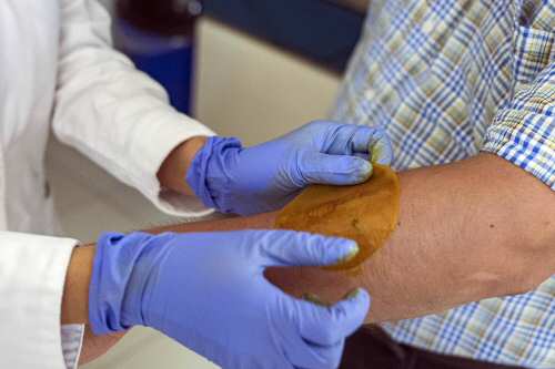 En la Unam han creado un parche hecho a base de productos naturales, que potenciará el proceso de recuperación. (Foto: Unam)