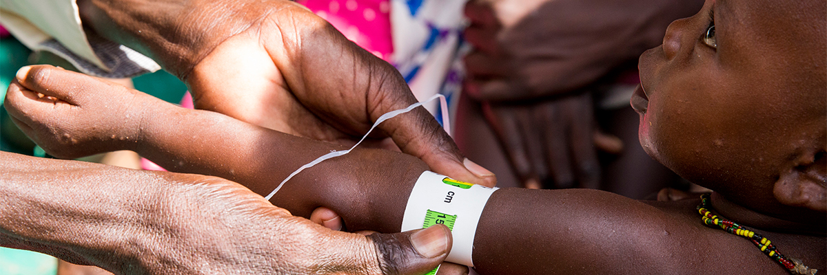 Un trabajador de la salud mide el brazo de un bebé durante el lanzamiento del plan de respuesta nutricional conjunta en Aweil, Sudán del Sur. Foto ONU/JC McIlwaine