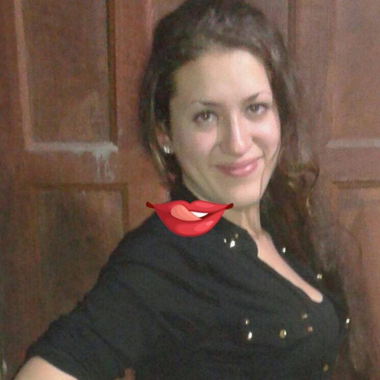 Cansada de que su novio la cele, se quemó el rostro para ser fea.
