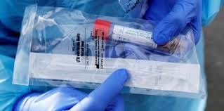 Alerta en el Gobierno por los kits para detectar el coronavirus que llegan de China