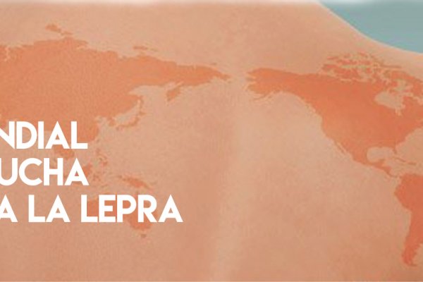 Día Mundial contra la Lepra